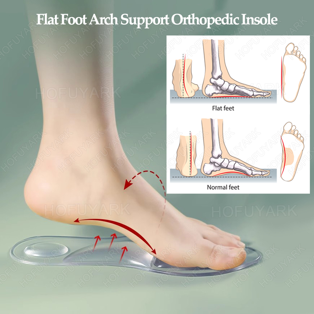 Силиконовые гелевые стельки, о – обзор и цена Women'S Shoes High Arch Support