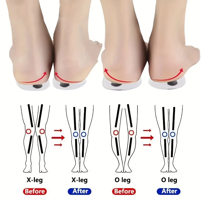 Ортопедические стельки для ног – обзор и цена Women Shoes Types